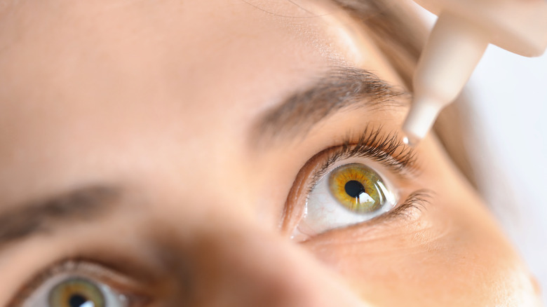 woman putting eyedrops in one of her eyes