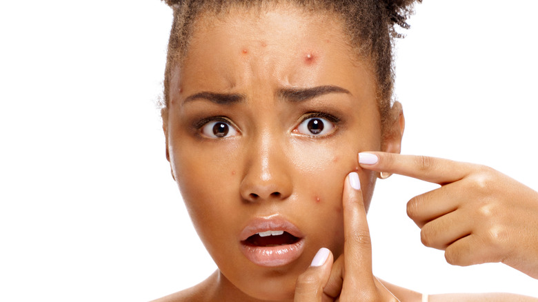 Woman with pimples