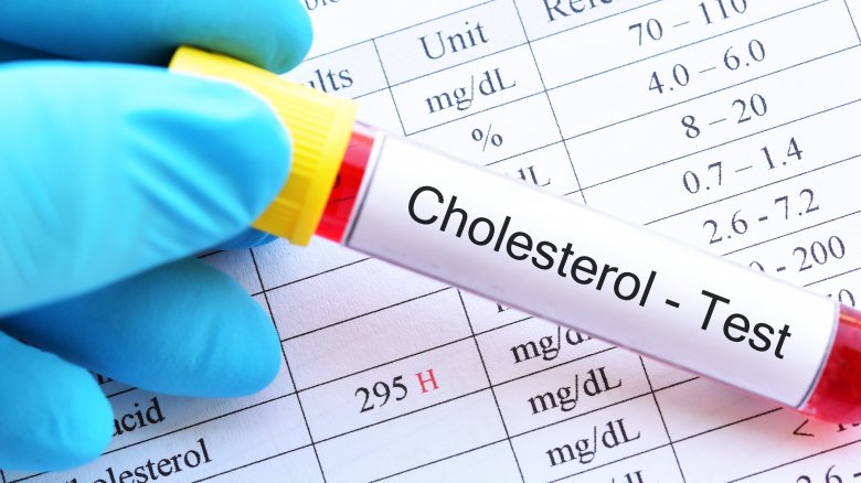 A cholesterol test