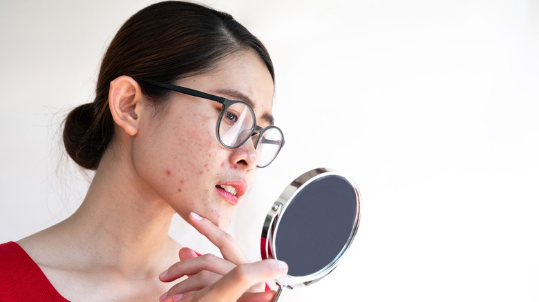 Woman checking acne in the mirror