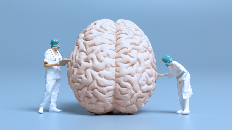 Model of doctors looking at a brain