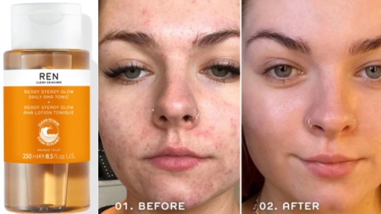 Skin toner and before and after image