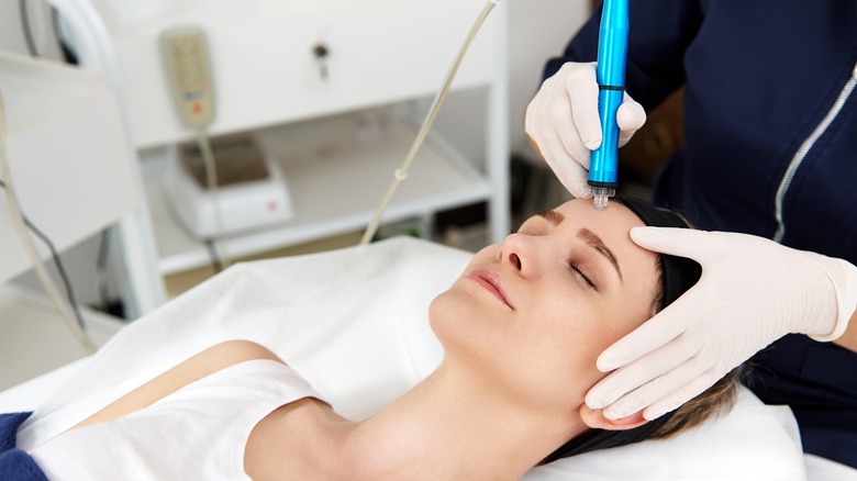 Woman getting microneedling on her face