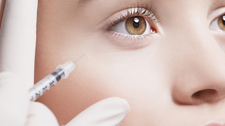 A woman getting under-eye fillers