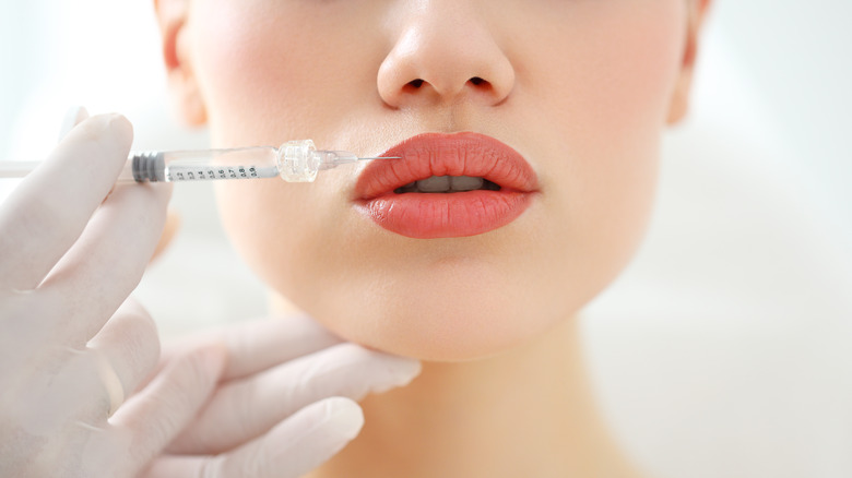 Woman receiving lip fillers