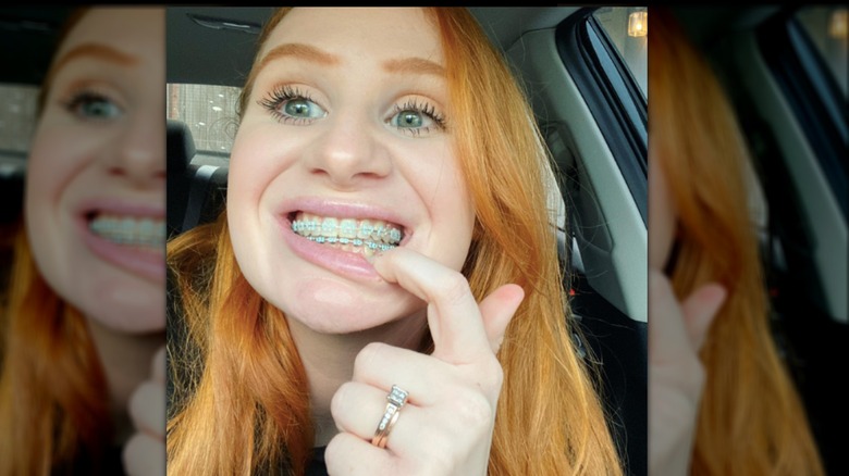 Ashley Elliott smiling with braces