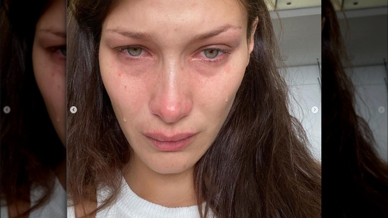 Bella Hadid Opens Up About Her Mental Health Struggles