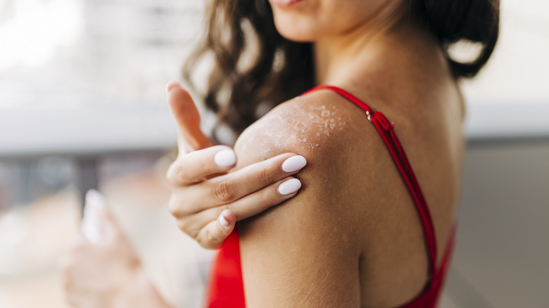 woman with dry shoulder skin