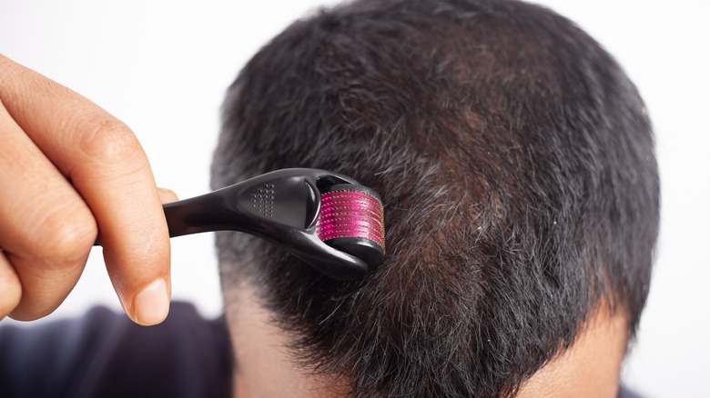 Man stimulating hair growth with derma roller