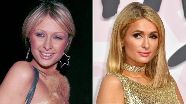 Paris Hilton before and after eyebrows