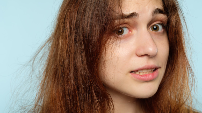 A woman with dry staticky hair