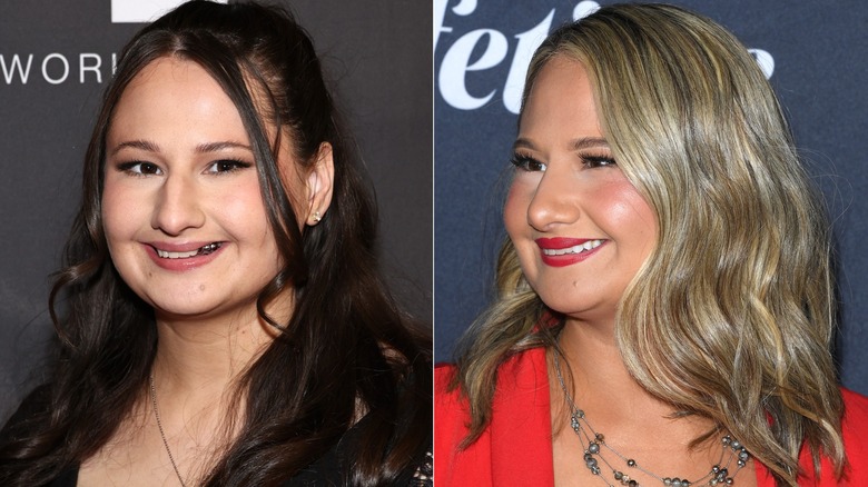 Gypsy Rose Blanchard before and after nose surgery