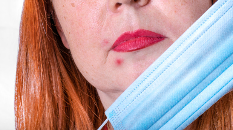 A woman removing a mask to show a blemish on her chin 