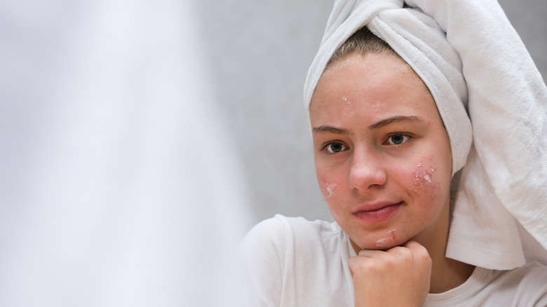 Girl with acne looking in mirror