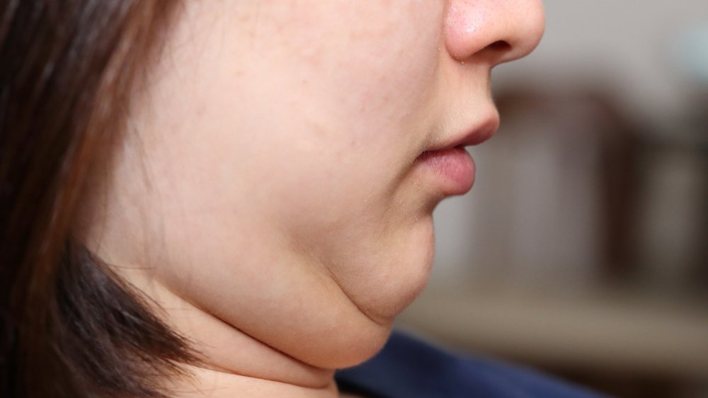 Woman with double chin