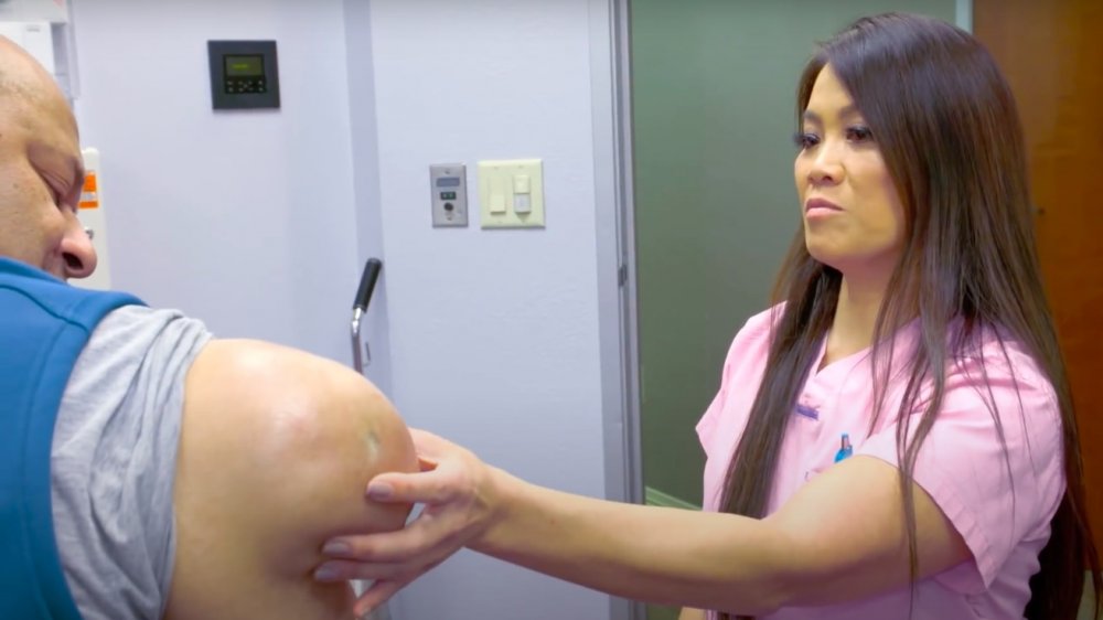 Dr. Pimple Popper's lipoma the size of a newborn