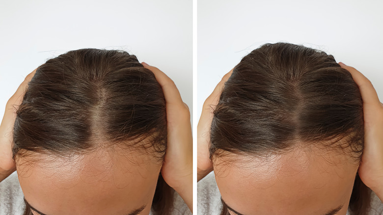 A woman's hair part, split-screen