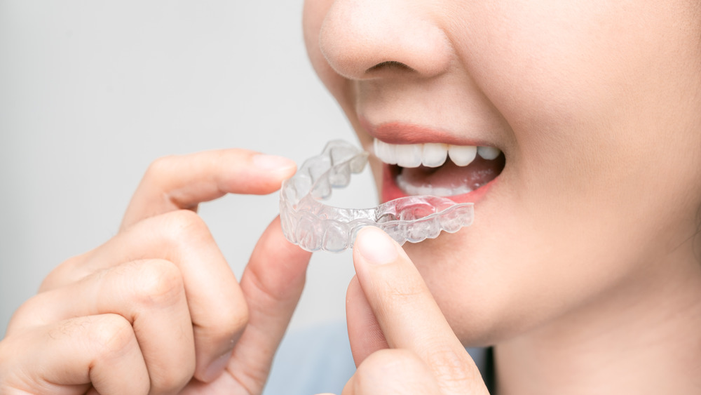 A woman putting in a teeth aligner tray 