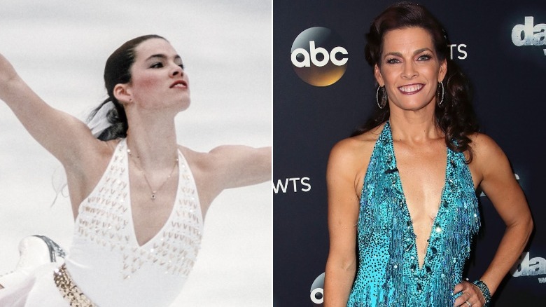 (L) Nancy Kerrigan in 1992 (R) Nancy Kerrigan in 2017