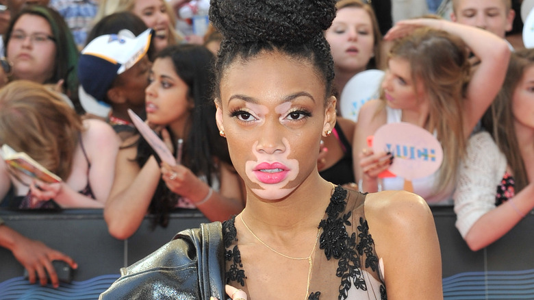 Winnie Harlow on the red carpet 