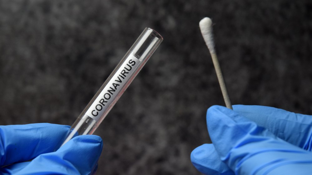 lab technician holding a test tube