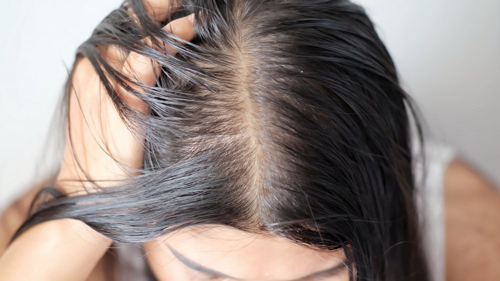 A woman runs her hand through her thinning hair 