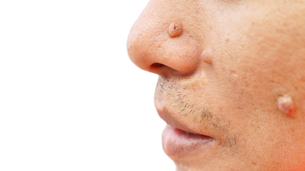 A close-up picture of a man's nose, lips, and chin.