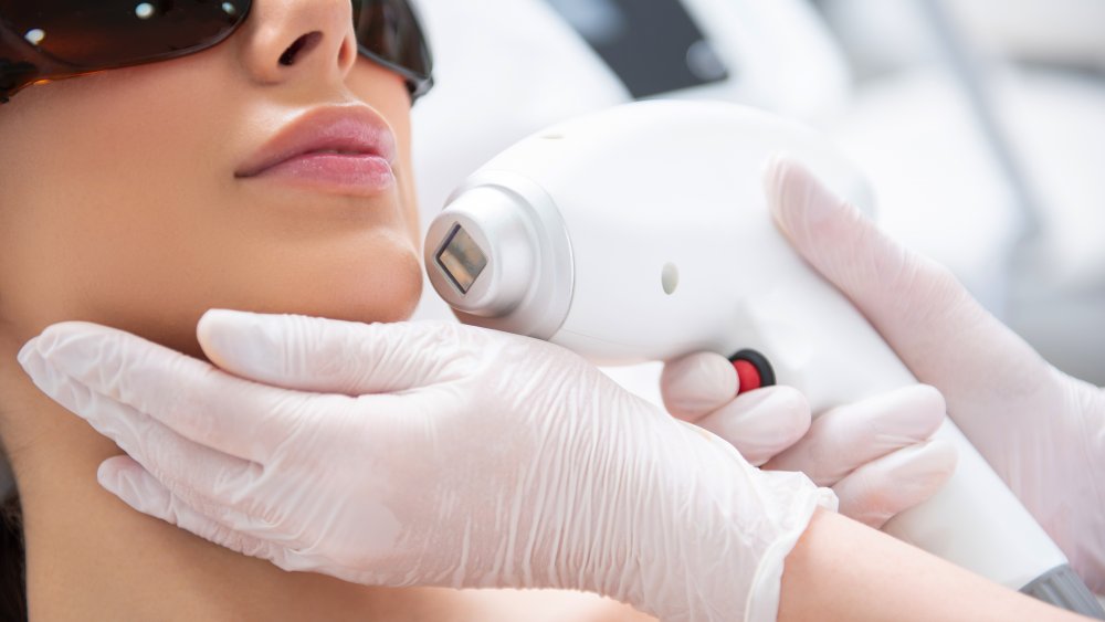 Woman receiving laser hair removal on face