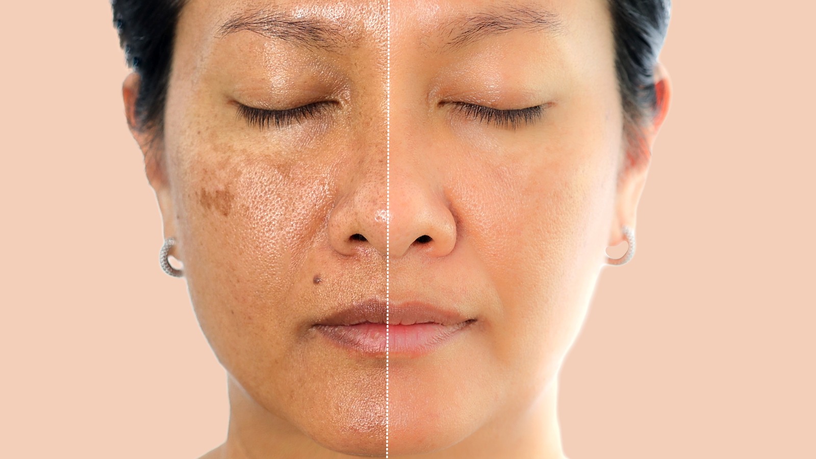 How Adding Tretinoin To Your Skin Care Routine Can Deliver Clearer Pores