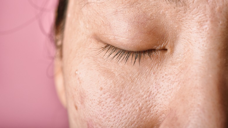 Closeup of woman's pores