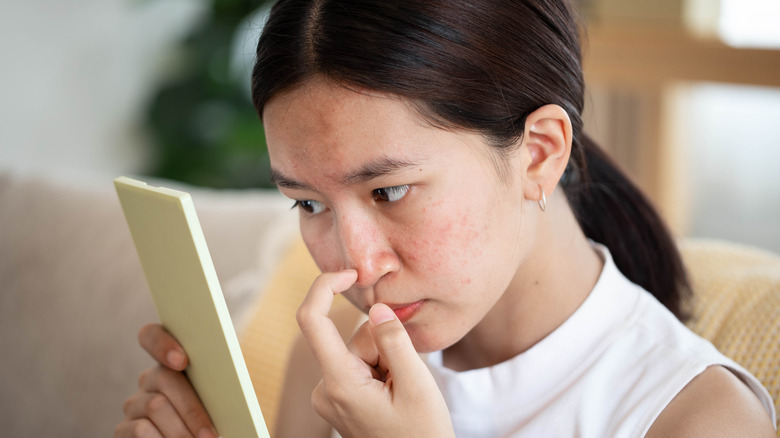 Woman looking at acne in mirror