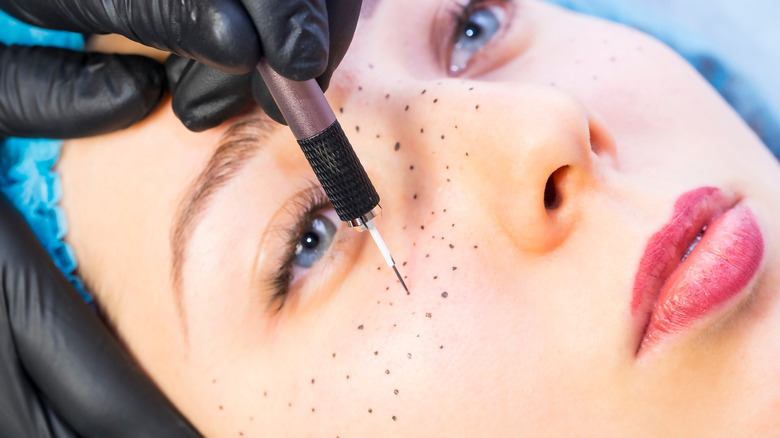 Woman getting freckles tattooed on her face