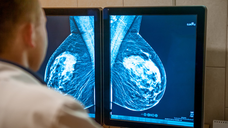 Doctor examining mammogram screen