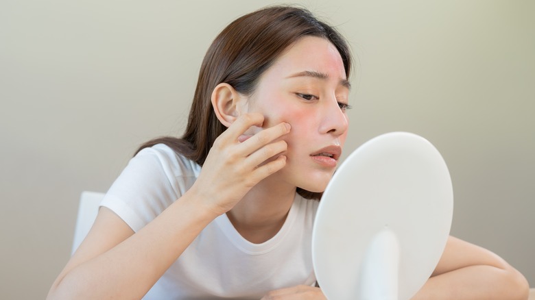 woman inspecting acne