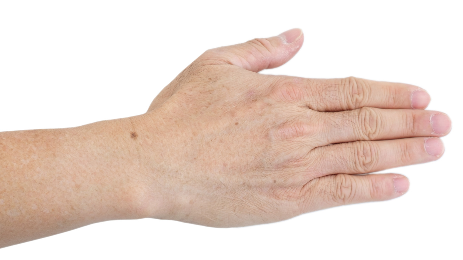 How To Deal With Darkening Age Spots On Your Hands