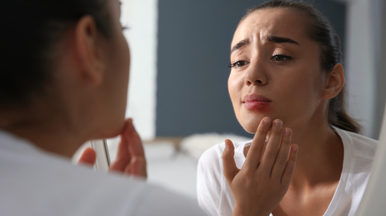 Woman eyeing her cold sore