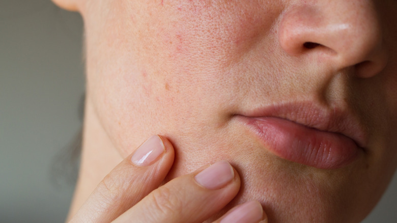 Woman examining her skin 