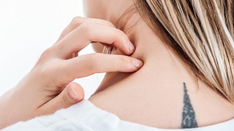 Woman with itchy neck tattoo