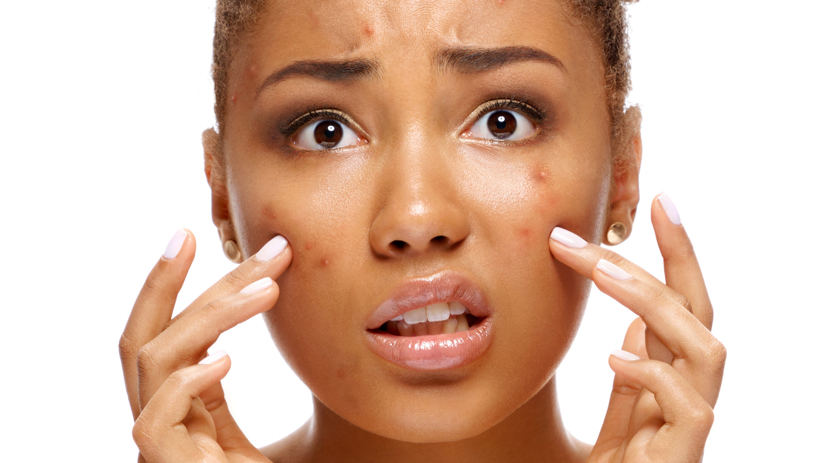 how-to-prevent-and-treat-post-inflammatory-hyperpigmentation-247-news