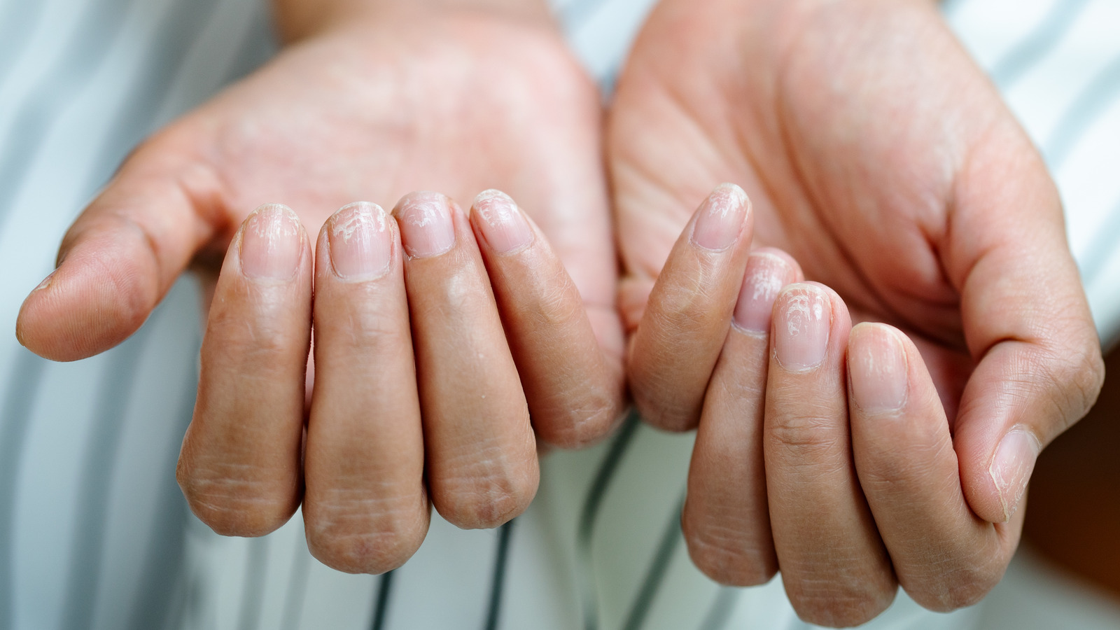 How To Revive Damaged Nails After Too Many Gel Manicures