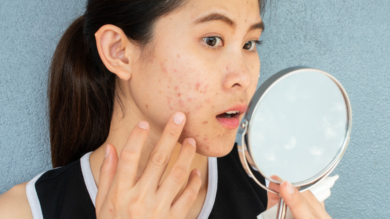 Woman looking at acne in mirror