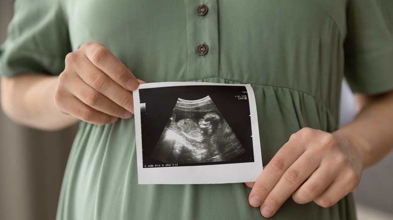 Pregnant woman holding an ultrasound photo of her baby