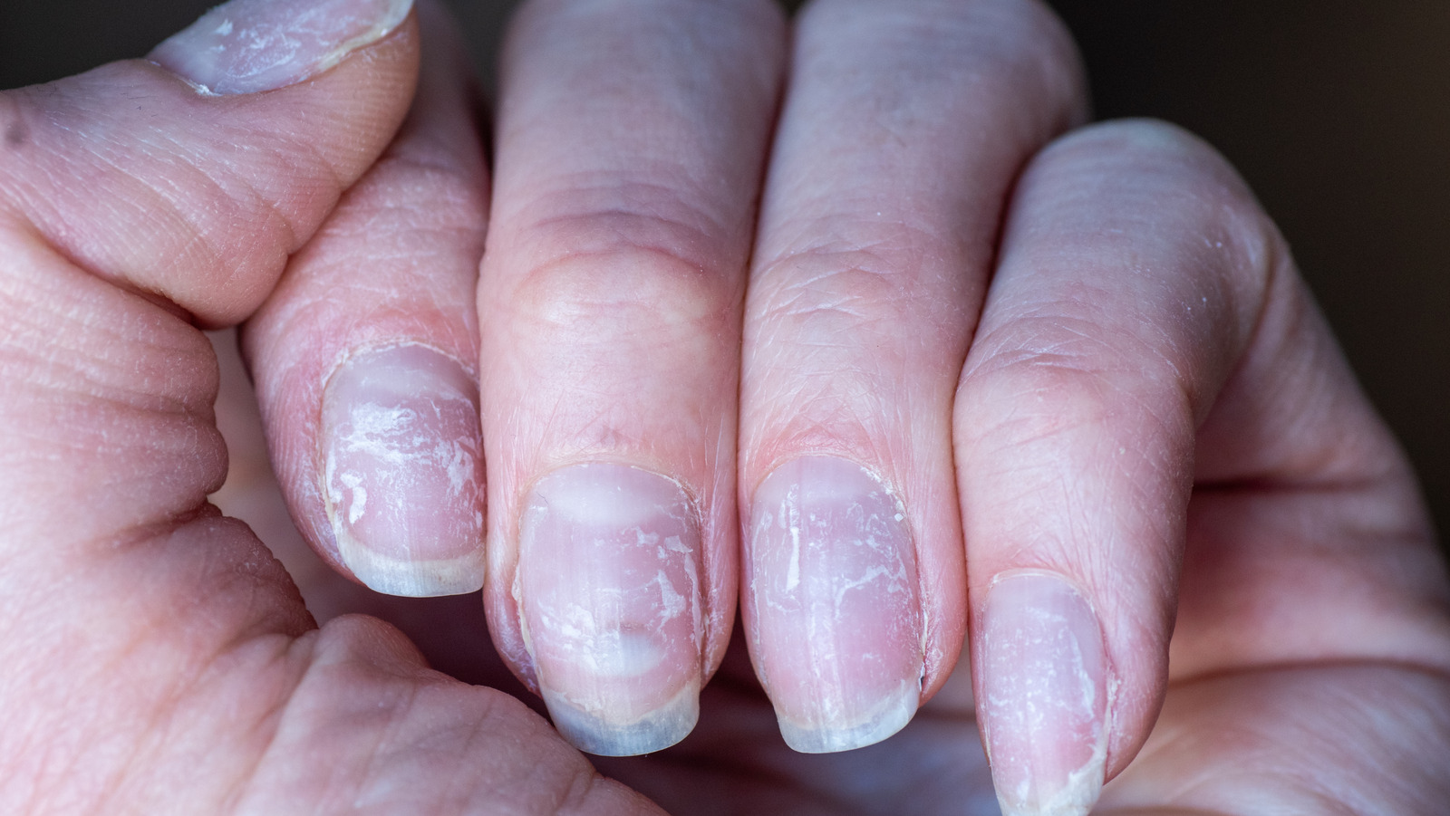 If You re Nails Are Peeling Here s How You Should Treat Them