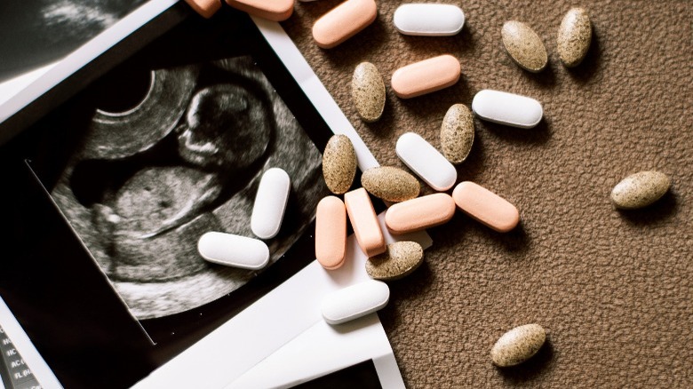 Sonogram with vitamins on the table