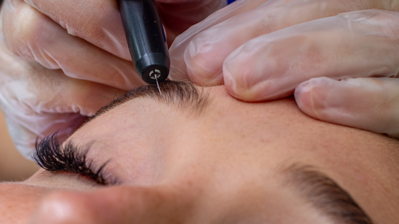 Person performing electrolysis on eyebrows