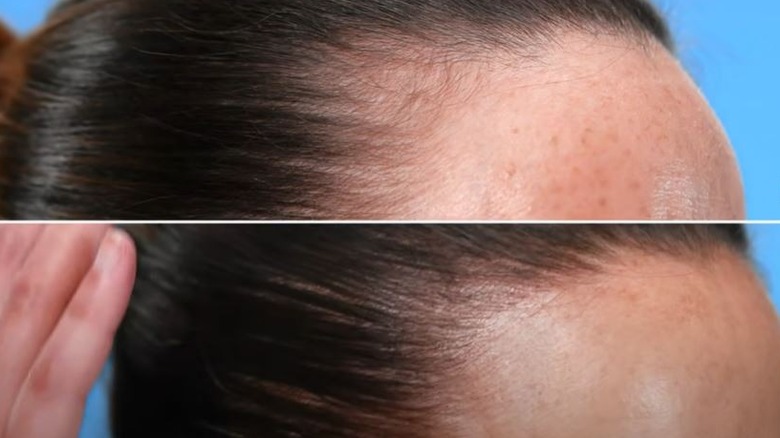 Is Microblading The Answer To A Receding Hairline 