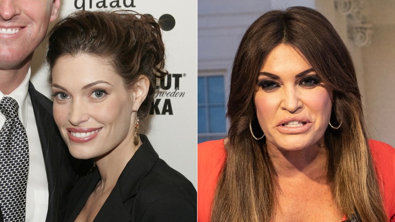 Kimberly Guilfoyle before and after