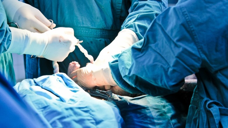 birth of baby surgery