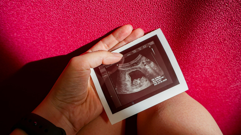 hands holding ultrasound picture