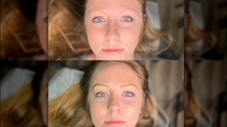 Before and after of an eyebrow makeover